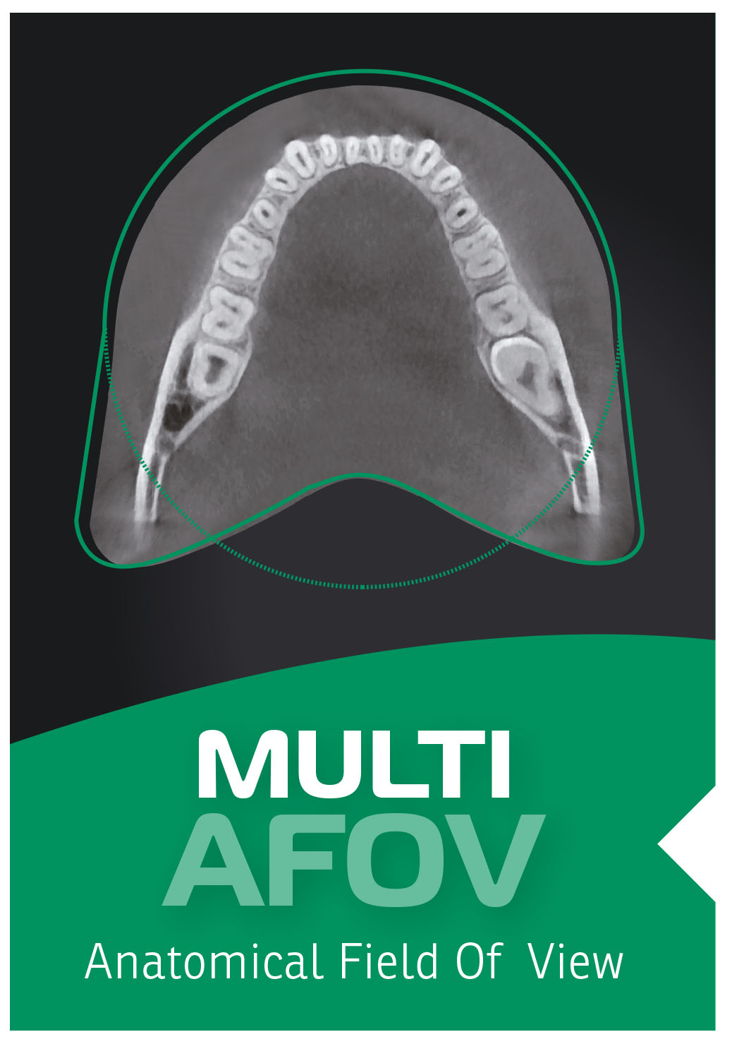 multi_A_FOV
