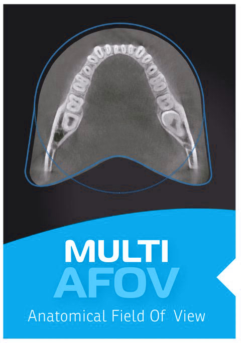 multi_A_FOV-TECNO